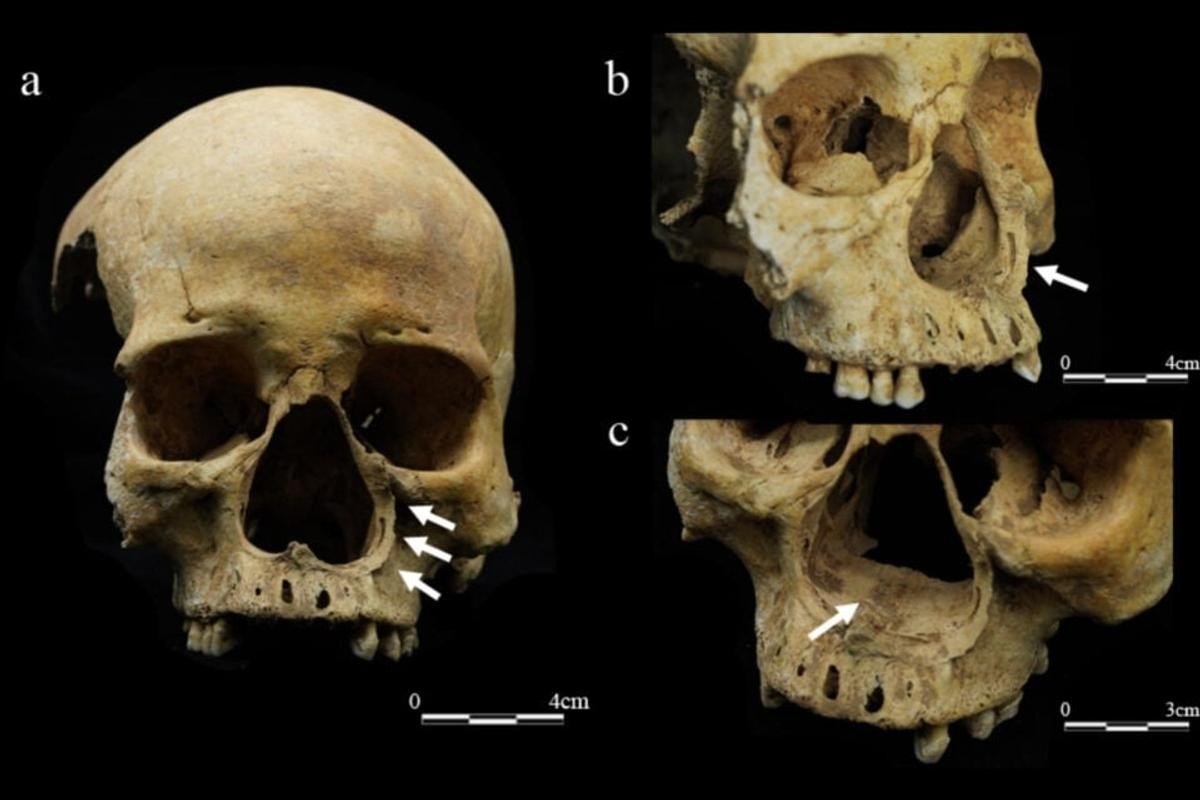 古代中国の文献にしかない「幻の刑罰」、人骨から初の証拠？（ギズモード・ジャパン）