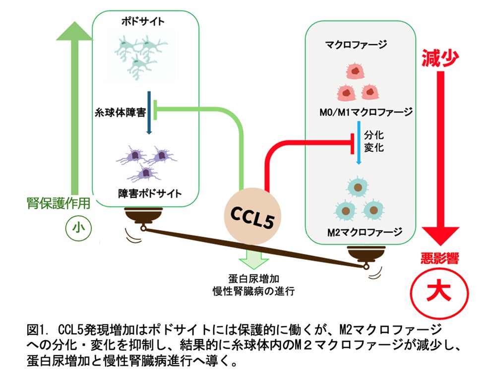 慢性腎臓病が進行するメカニズムの一端を解明～ケモカインであるCCL5の慢性腎臓病における相反する役割を発見～
