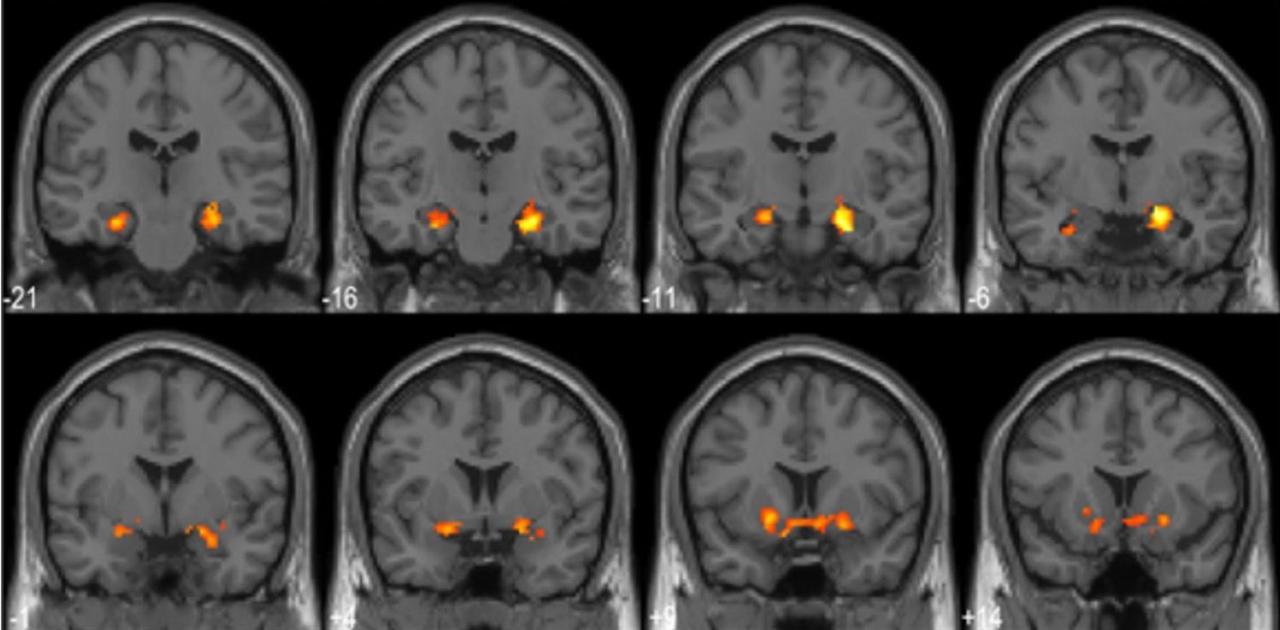 ｢アハ体験｣は脳を活性化する。記憶力も2倍に