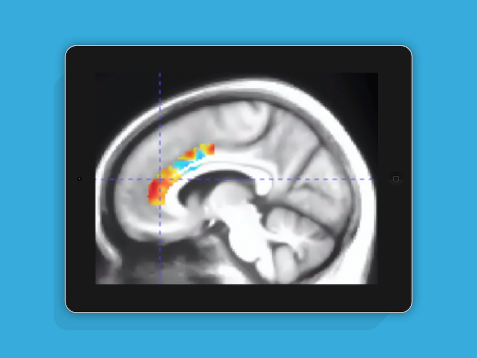 「脳トレゲーム」の効果を示す研究結果。10週間の脳トレが、脳の一部で“老化10年分”を打ち消す可能性