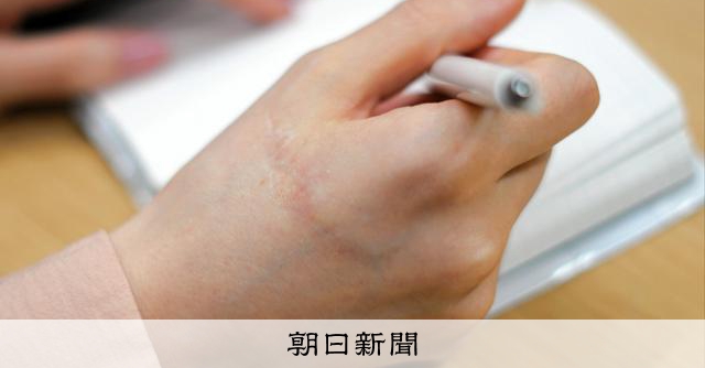 警察が「見舞金」支払い和解へ ファンに刺される前の相談対応めぐり