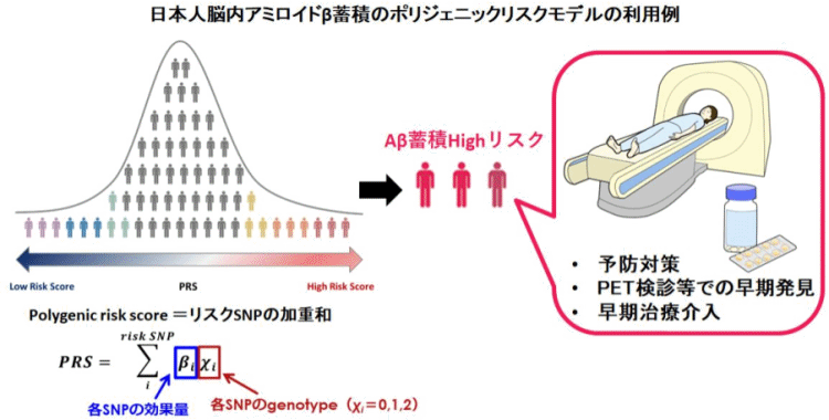 日本人のアルツハイマー発症リスクが遺伝子情報から予測可能に 将来の脳内アミロイドβ蓄積リスクを高精度に予測するモデルを開発 慶應義塾大学とエーザイ