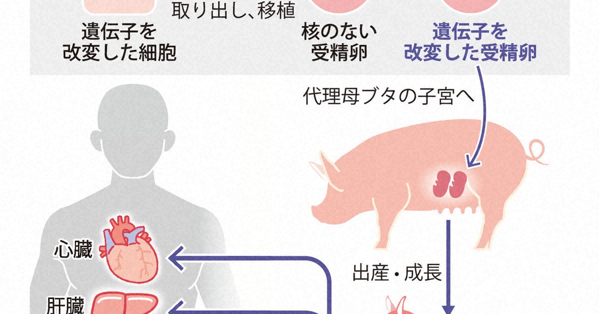 ブタ腎臓の異種移植「55～65歳の患者が候補」 北大試算
