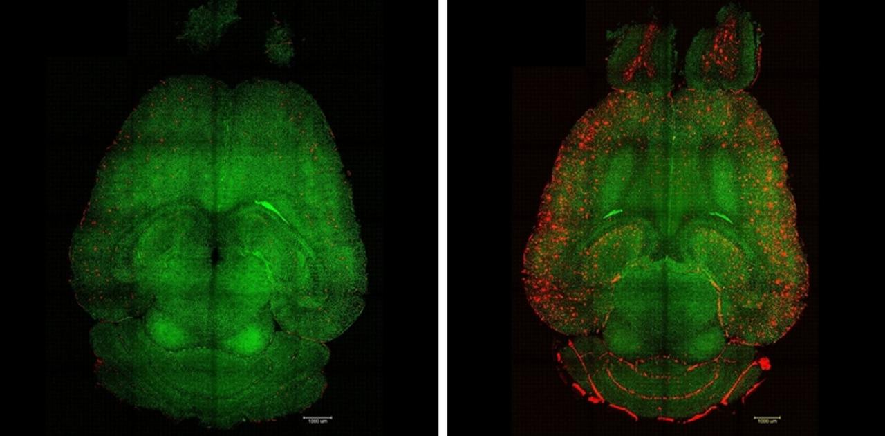 アルツハイマー病、治療できるかも。マウス実験で脳のダメージ修復に成功