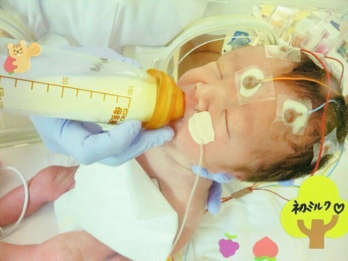 「出生時の後遺症で『脳性まひ』になった息子。数少ない『できること』を奪いたくないと、胃ろう手術に迷い…」（絵本『おなかのボタン』著者インタビュー）（たまひよONLINE）
