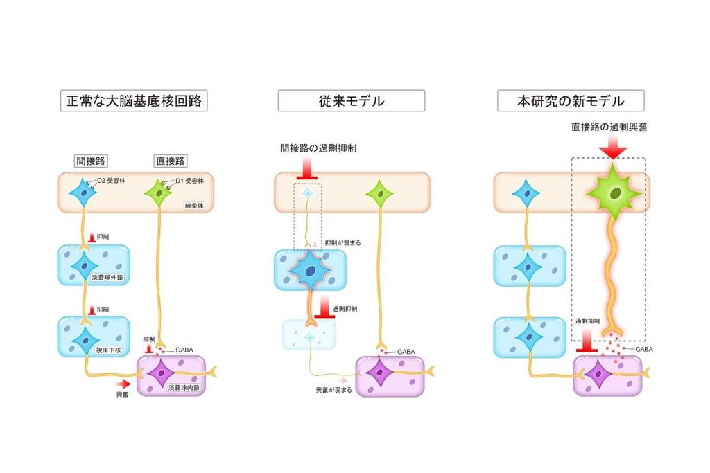弘前大学医学研究科の引地浩基助手らの研究グループが抗精神病薬の副作用である遅発性ジスキネジアの発症機序を解明：紀伊民報AGARA｜和歌山県のニュースサイト