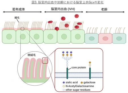脳室守る“糖のバリア”が老化や出血で壊れる仕組みを究明 岐阜大学