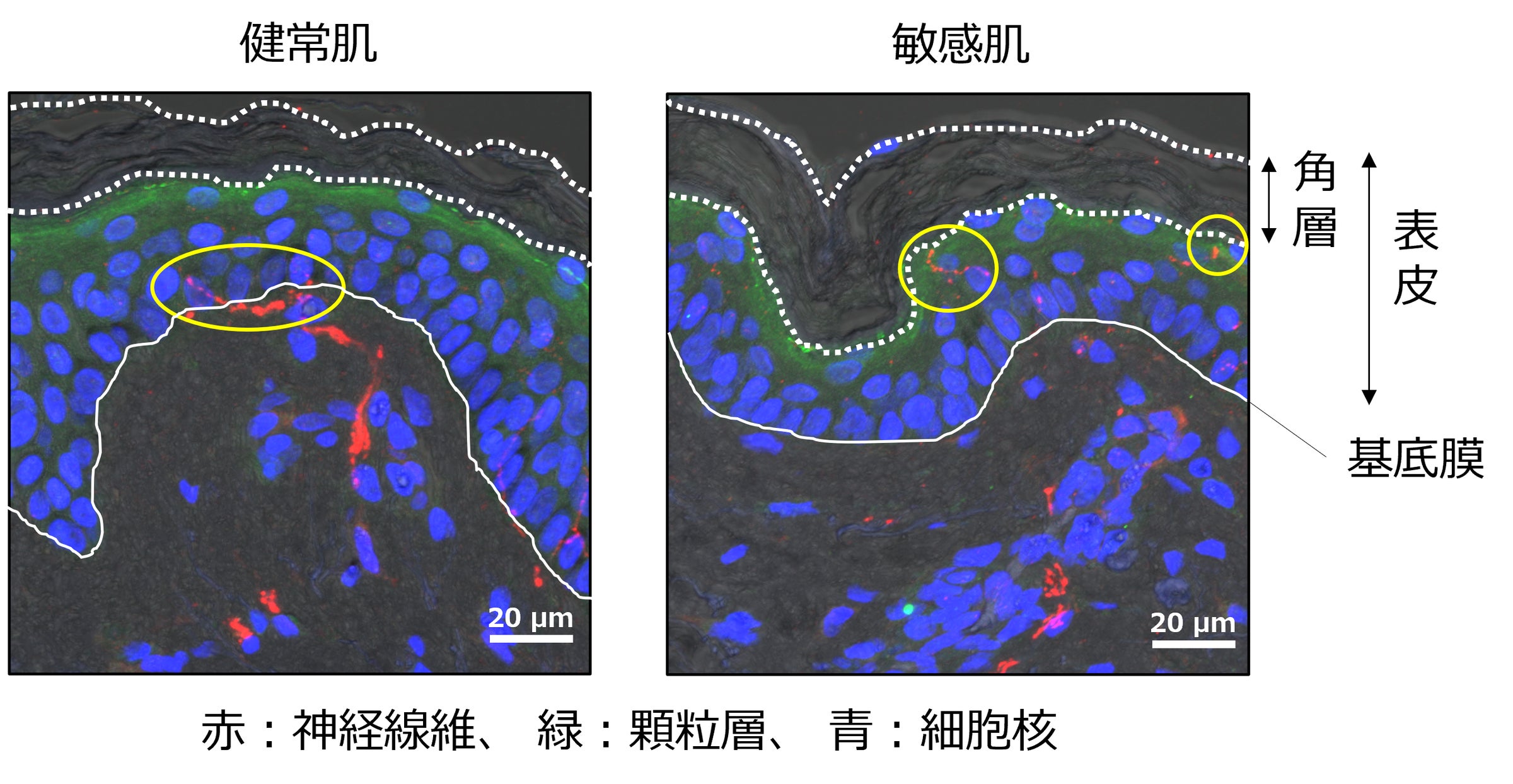 敏感肌における知覚過敏のメカニズムの一因を明らかに