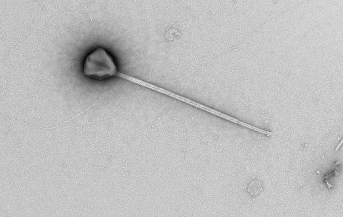 史上最長の「尾」を持つ巨大ウイルス、ハワイ沖で発見される