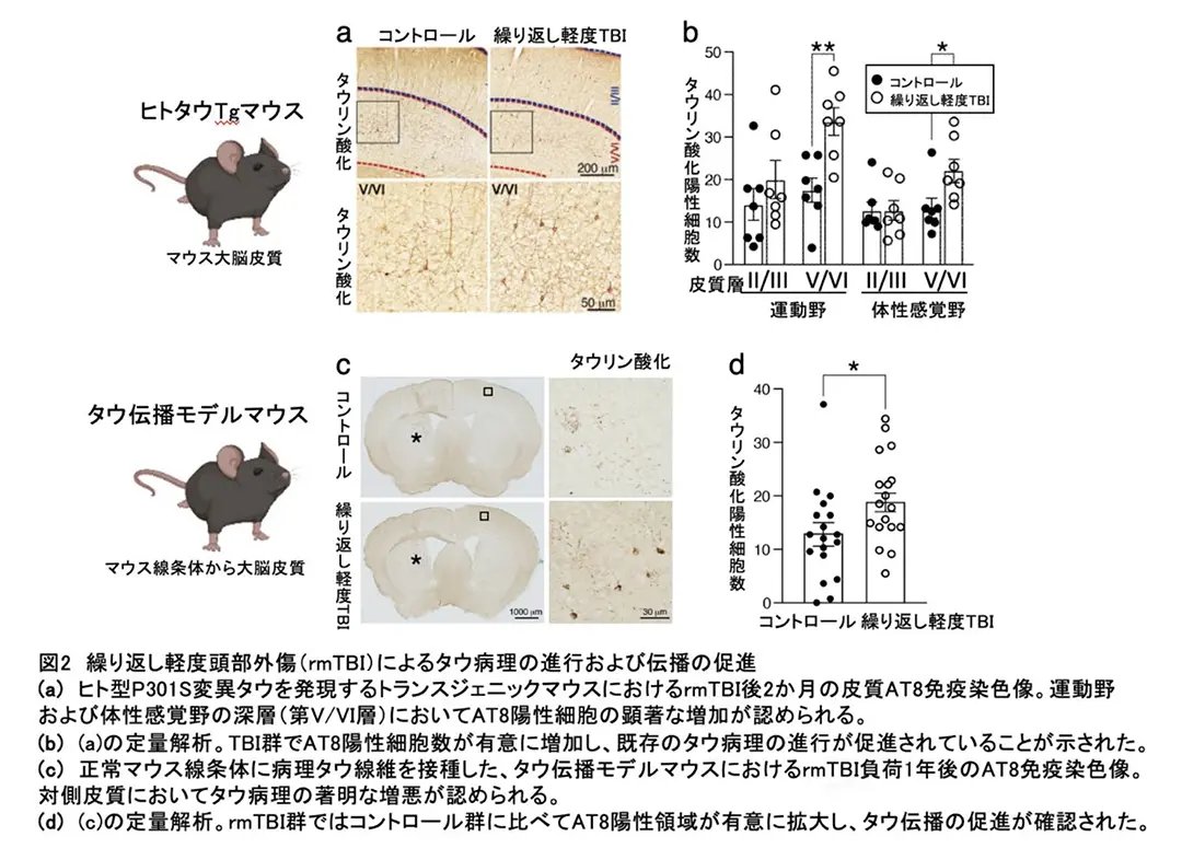接触スポーツなどによる反復的な軽度頭部外傷は、認知症で見られる凝集体タンパク質の広がりを加速させる―ヒトの頭部外傷を再現するマウスモデルによる慢性外傷性脳症の研究―