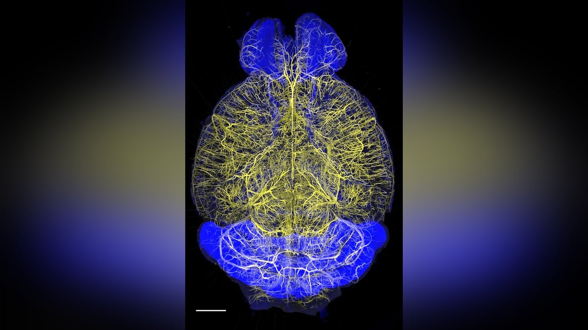 臓器を透明化 より深く観察…薬成分の集散、神経の活動鮮明に