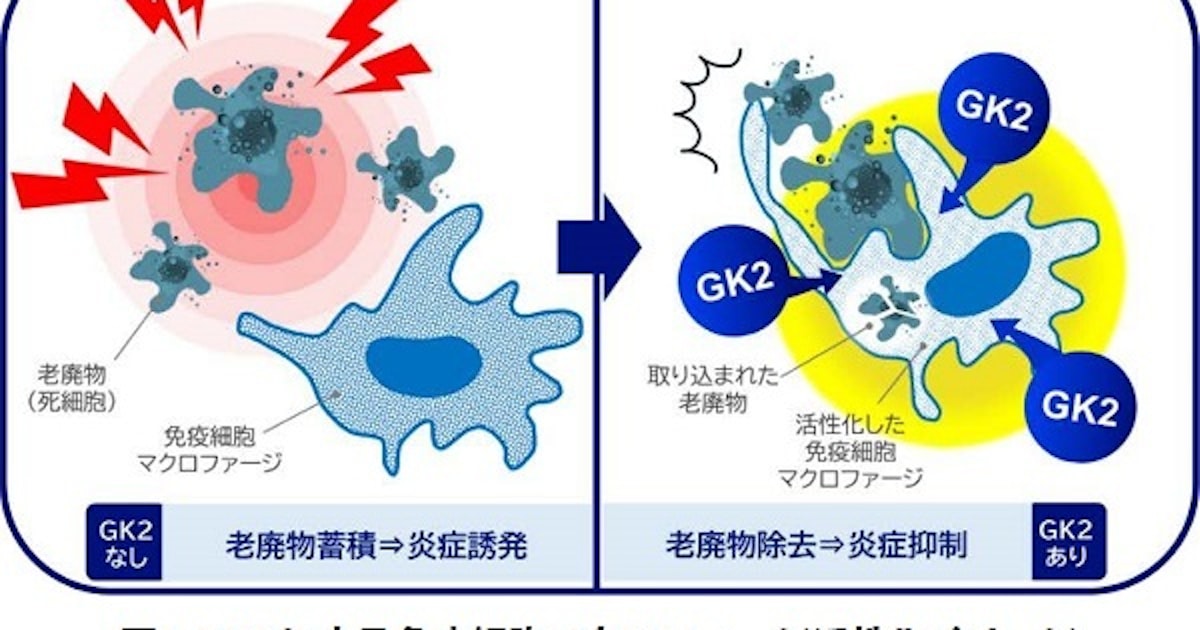 ライオン、歯周病の発症・進行予防には歯ぐきの免疫機能が重要であることを確認