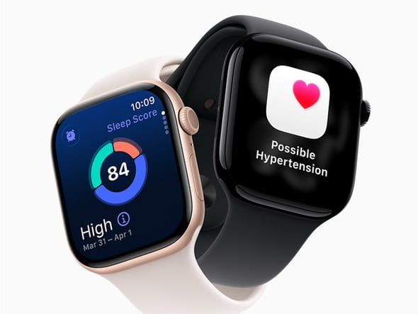「Apple Watch」の“高血圧通知”は血圧計にあらず 旧機種も一部対応する、その内容とは？