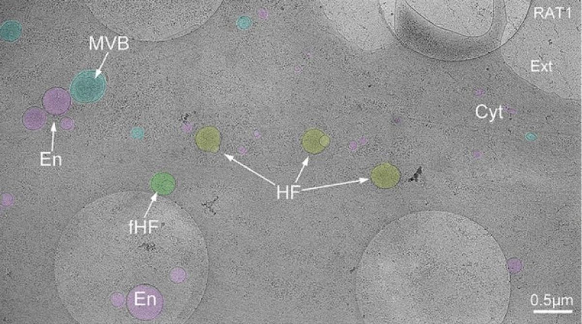 人間の細胞の中に新たな小器官「ヘミフソーム」が発見される