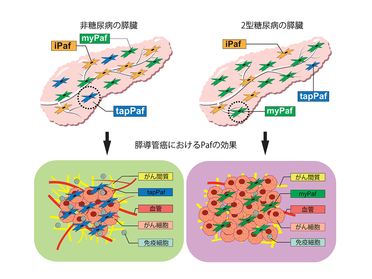 新規膵星細胞亜集団を介した糖尿病による膵導管がんの進展機序解明について