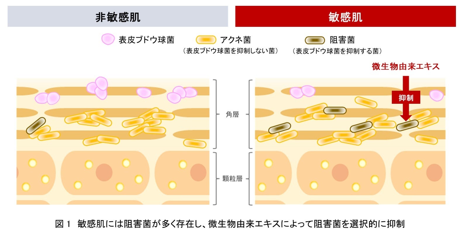 資生堂、菌叢研究を通じて敏感肌には表皮ブドウ球菌の生育を阻害する特殊なアクネ菌が多いことを発見 ～特殊なアクネ菌を選択的に抑制する効果を微生物由来エキスに発見～