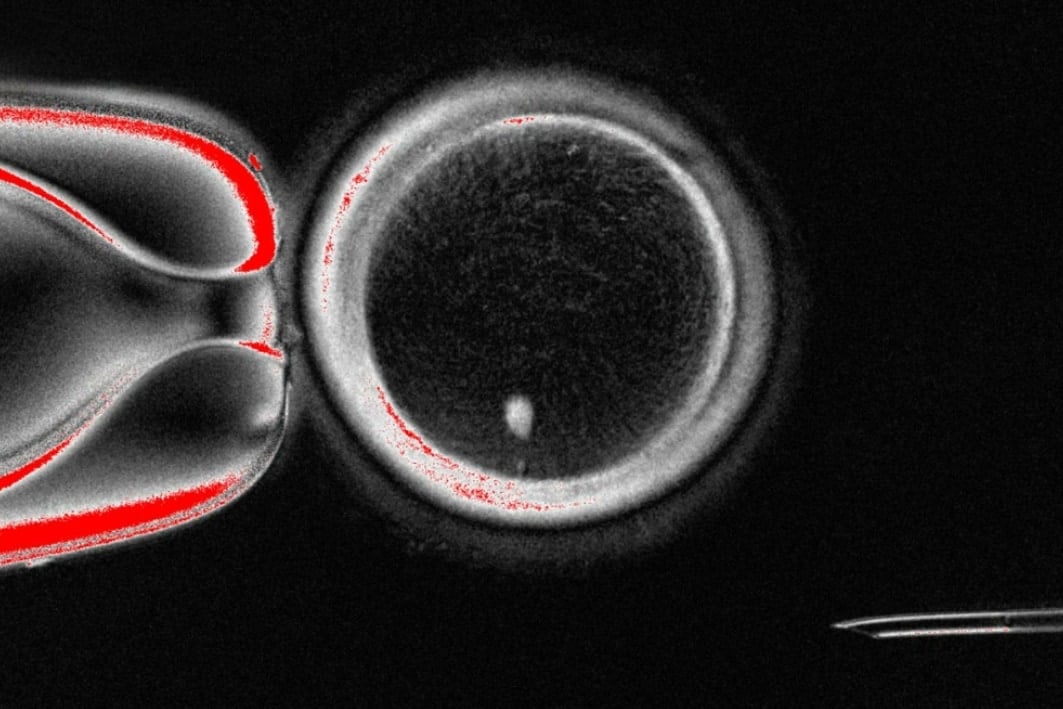 ヒト皮膚細胞から卵子を作り受精させ初期胚まで成長させることに成功！