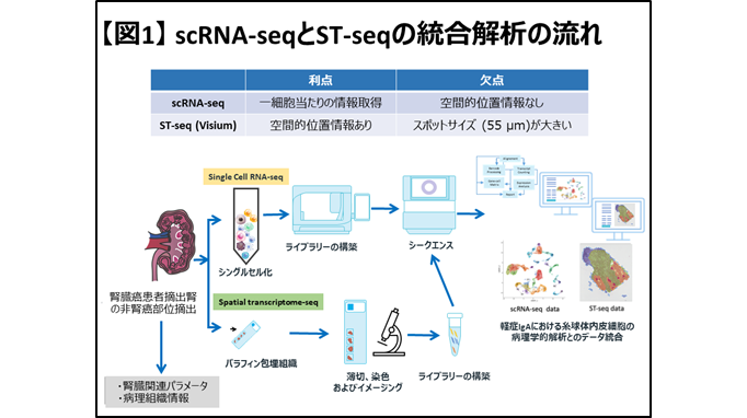 ヒトIgA腎症の発症・悪化に糸球体内皮細胞の炎症が関与することを先端的解析技術によって証明（北里大学）