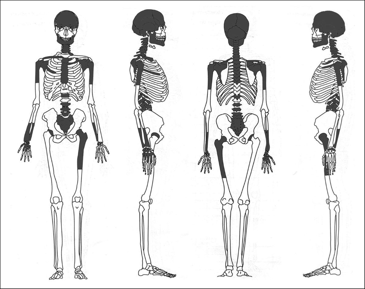 鉄器時代のスコットランドの女性、埋葬前に脳をすくい取られていた可能性 新研究