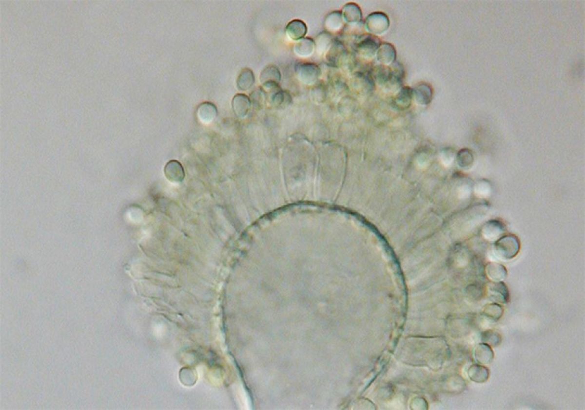 ツタンカーメンの墓の呪いの真菌から得た化学物質を改良し、白血病治療に役立てる試み