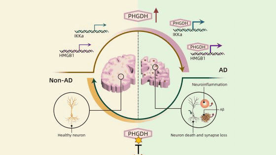 AIを用いた研究でアルツハイマー病の原因解明へ一歩前進、新たな治療候補の特定を実現