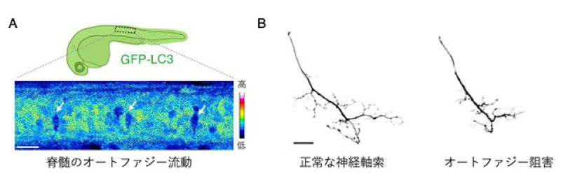 ALSの病態の謎。 なぜ体の動きだけ奪われるのか？