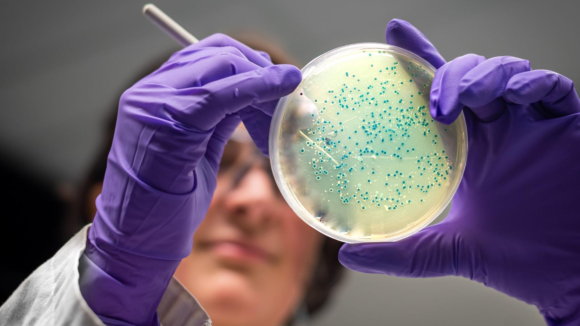 AIが「スーパー耐性菌」に有効な抗生物質を設計 淋菌とブドウ球菌で