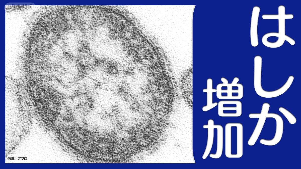 【はしか患者が増加】1回かかったから大丈夫…ではない！ 防ぐ方法は？感染したらどう対処する？【専門家が解説】