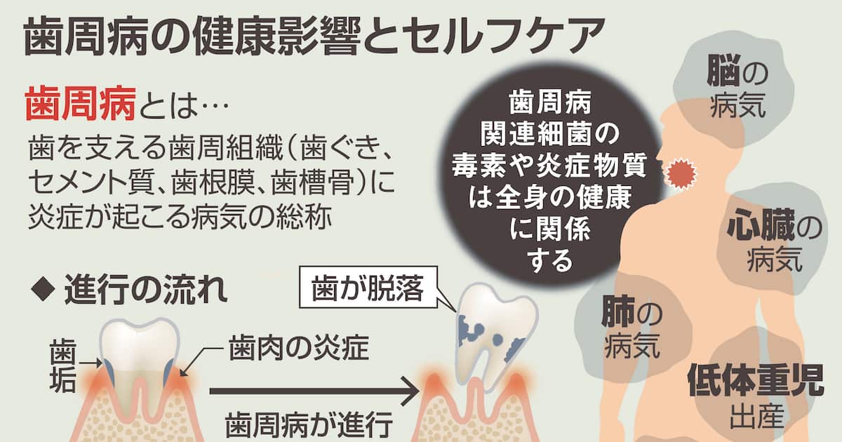 「お口の菌活」が歯周病を防ぐ 除菌にプラスする新知見で健康長寿を