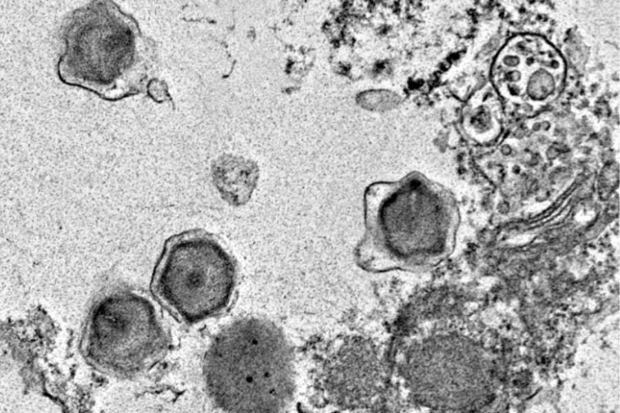 世界各地の海から「未知の巨大ウイルス」230種類を発見｜ニフティニュース