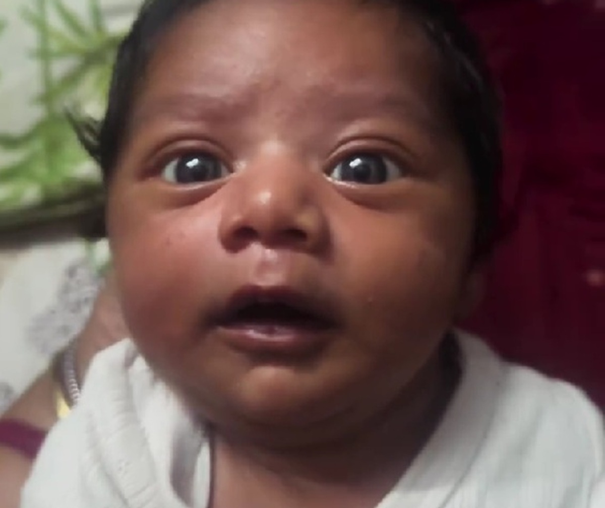 “じゃがいもみたい”と言われた赤ちゃん→10カ月後…… 目を奪われる姿が360万再生「なんて美しい瞳なの」「うわあああ！」【海外】