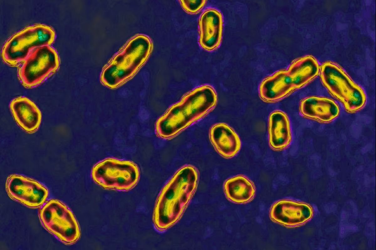 中世の黒死病の大流行、火山の噴火が引き金か 新研究