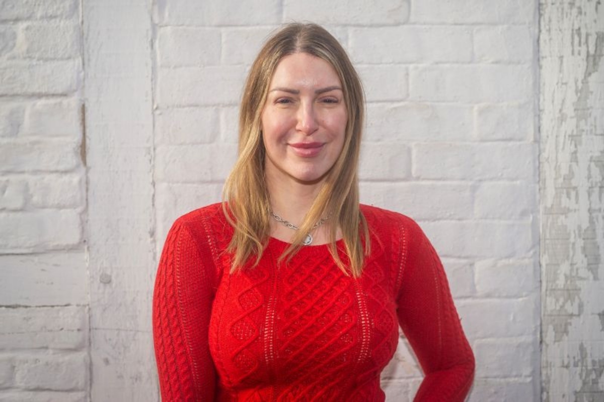 女性の植毛手術が急増中、ただしその成功率は――