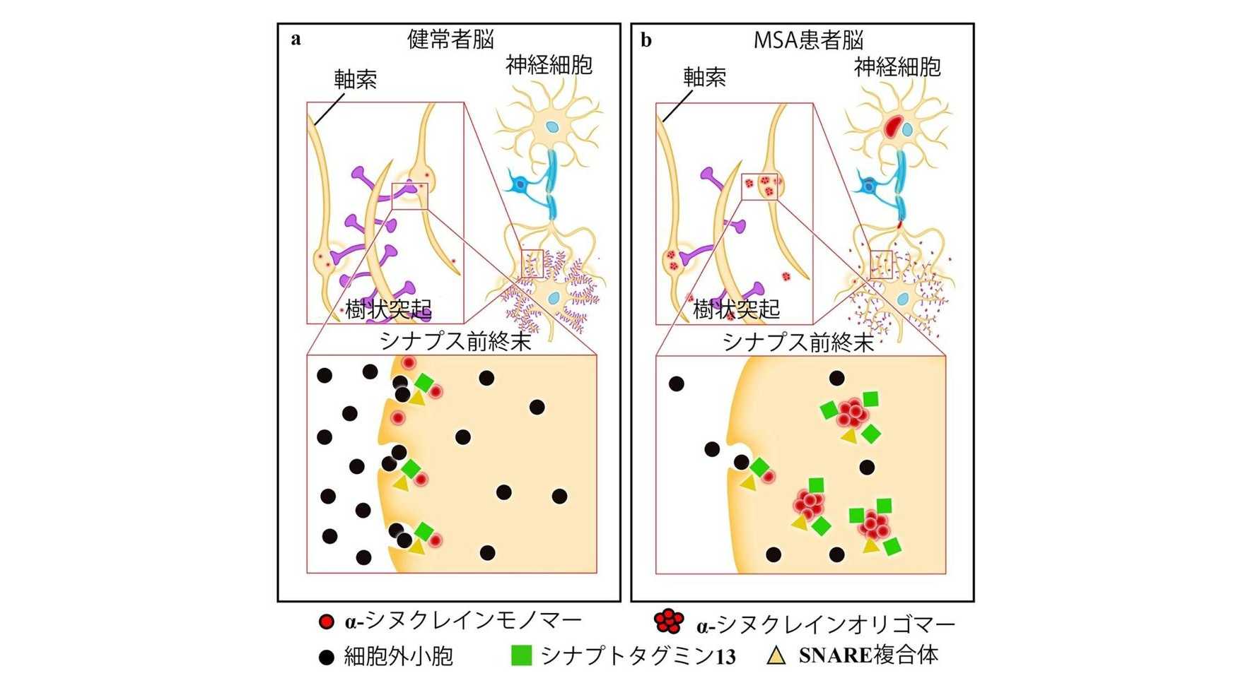 弘前大学の三木康生助教らによる研究グループがレヴィ小体型認知症や多系統萎縮症における認知症の成因を発見