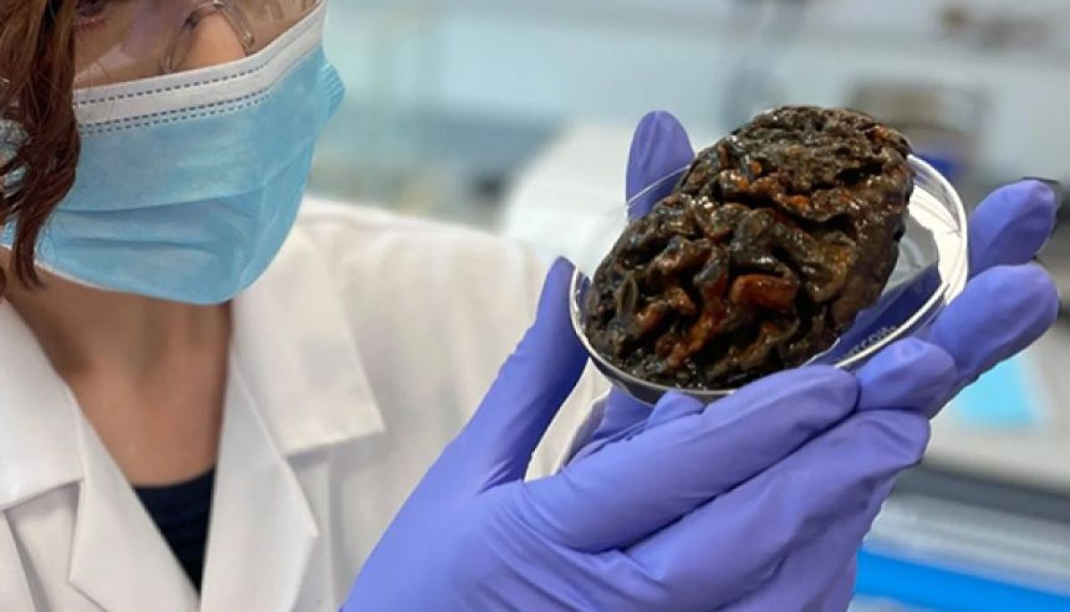 200年前の人間の脳からタンパク質を抽出することに成功、神経疾患の手がかりを発見