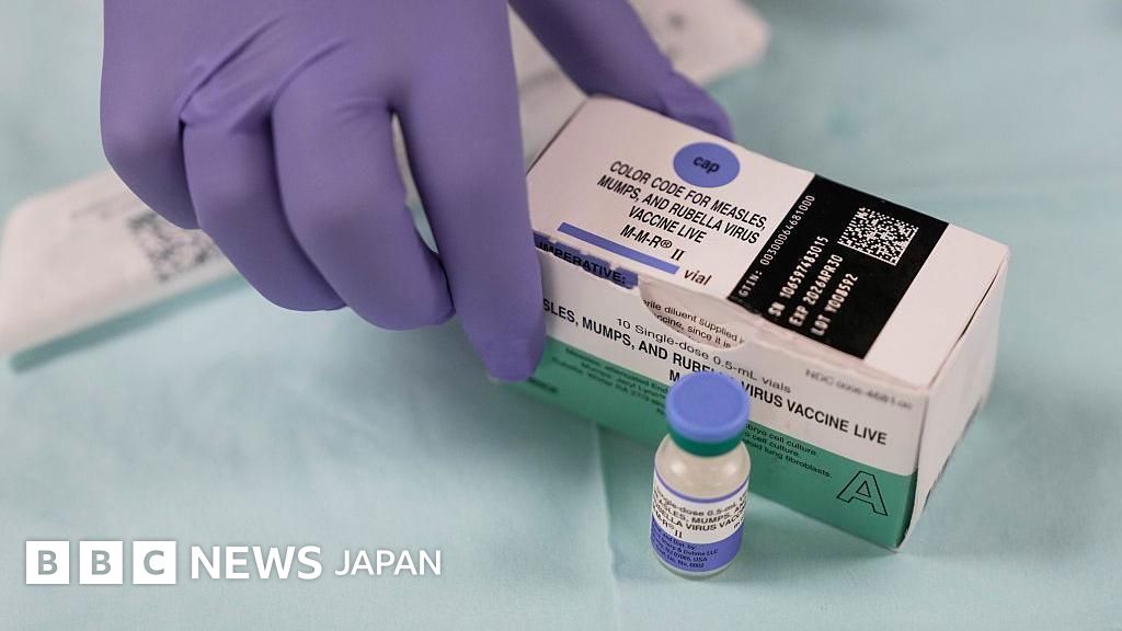 アメリカではしかの感染拡大、症例数が過去33年で最多に