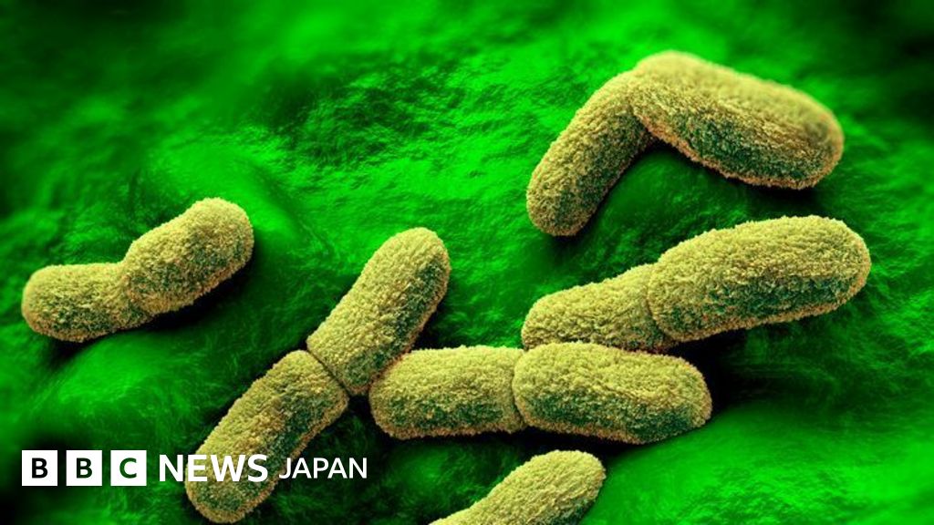 ロシアのペスト研究所の職員が死亡、アメリカは事態を「注視」していると
