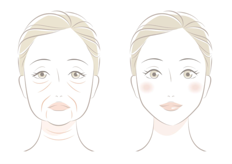 40代から急増！ 顔のたるみは骨から始まる!? 整形外科医が教える「骨活」で見た目も若々しく