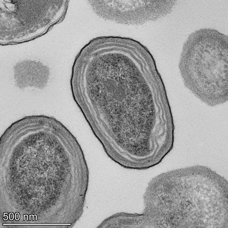 ＜1分で解説＞酸素を生み出すプランクトンの危機と地球温暖化（毎日新聞）