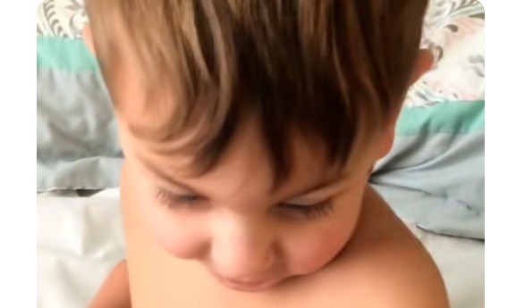 息子の顔に「異変」が...珍しい「皮膚がん」に気づいた母親のSNS投稿が話題に「病院には怒りが湧く」（ニューズウィーク日本版）