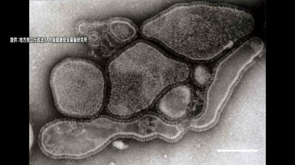 【不安】中国で呼吸器感染症「ヒトメタニューモウイルス」増加…日本でも感染者 延べ90億人移動の春節に感染拡大か 肺炎など重症化の恐れ「ゼーゼー気道の症状強い場合は検査おすすめ」