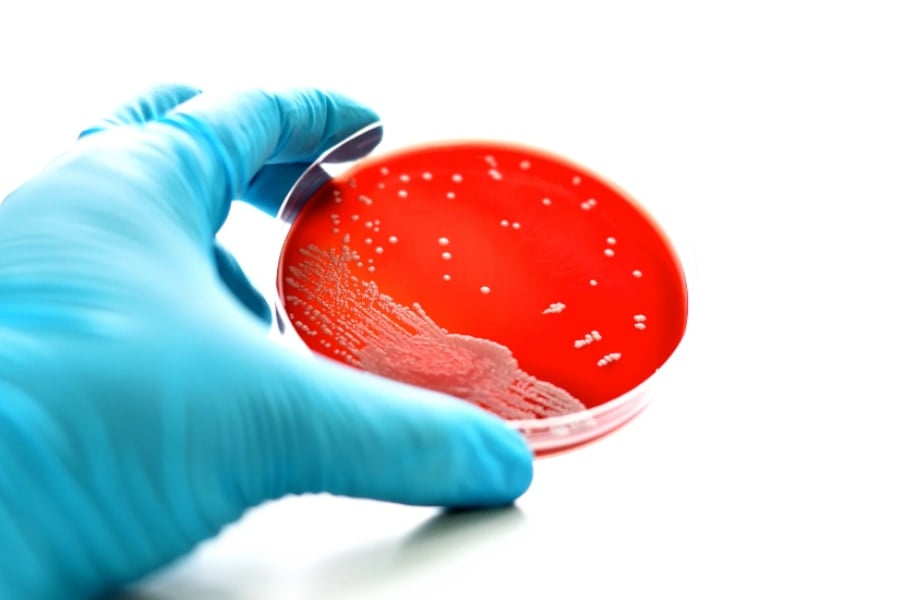 3歳児が実験皿で培養していた「淋菌」を誤食してしまった事件 (2/2)