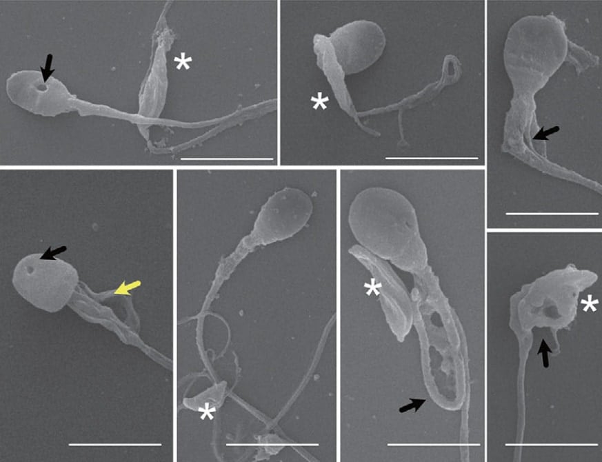 猫の寄生虫は5分で人間の精子の頭を切断できる
