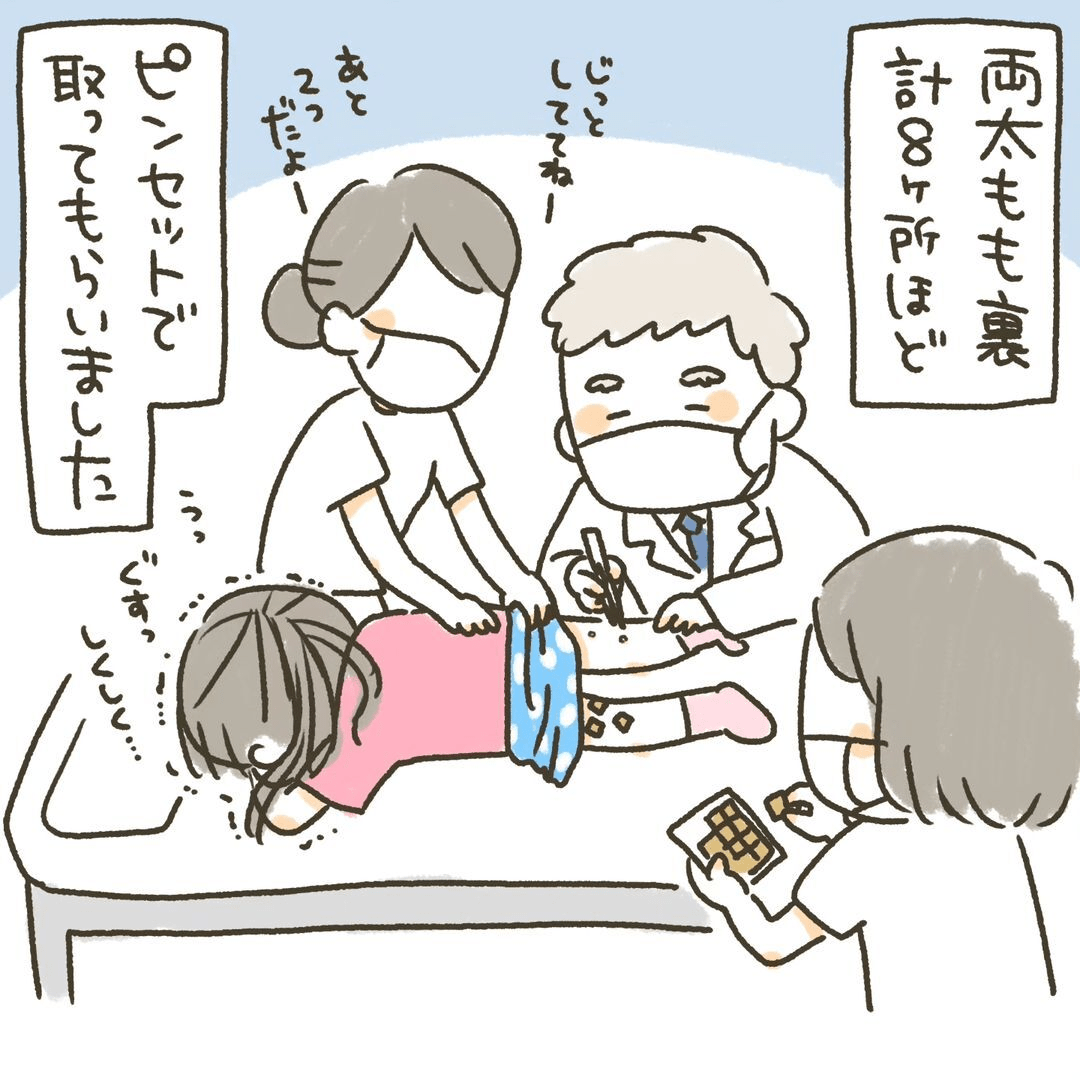 【漫画】太もも裏に“水イボ”ができた娘 麻酔せず、ピンセットで一つ一つ除去され…治療後にさらなる悲劇が