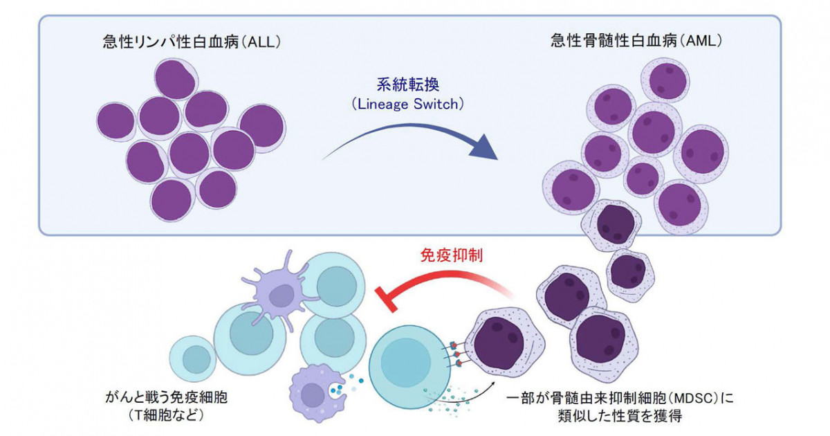 白血病の“系統転換再発”による免疫逃避―マルチオミクス解析で免疫抑制性を解明―