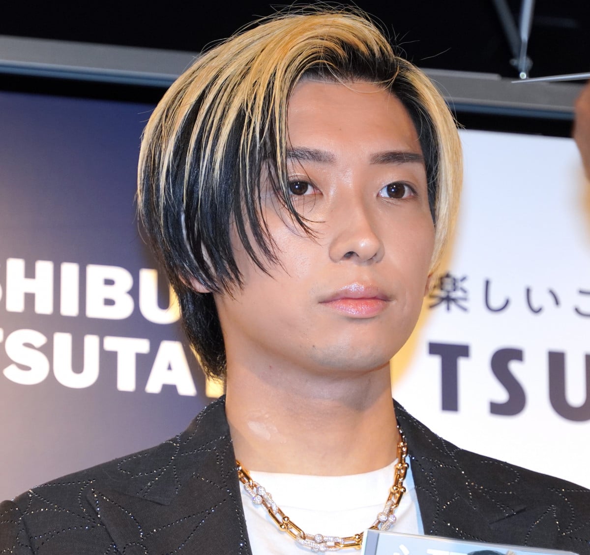 ヒカル、女性化乳房症を告白 原因は不明…「最近不安状態だったので」