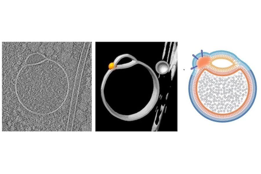 ヒト細胞に「未知の小器官」を新発見！「ヘミフュソーム」と命名 (2/2)