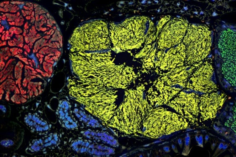 「半分生物で半分細胞部品」のような最小のゲノムを持つ生命体を発見 (2/3)