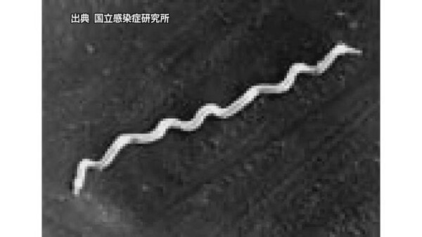 愛媛の今年の梅毒感染 男性は過去５年最多上回るペース 半数が性風俗産業利用 コンドーム利用を【愛媛】