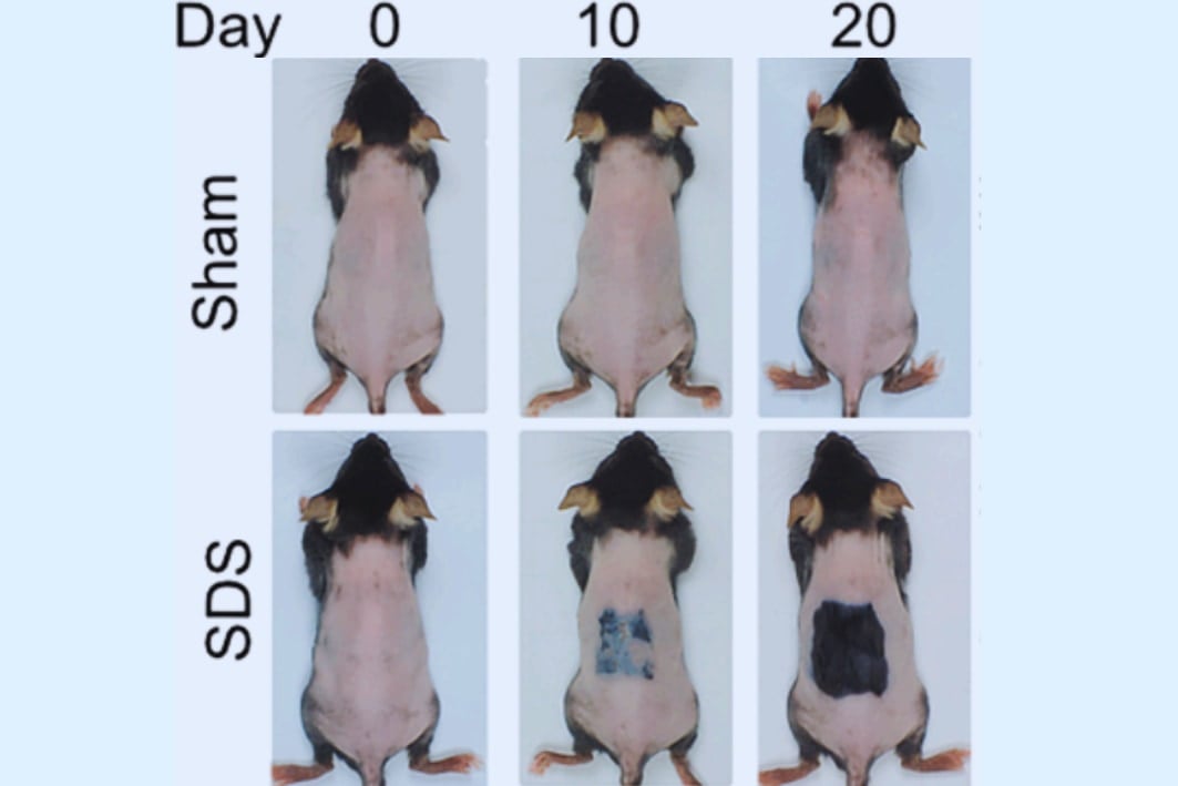 「傷跡にやたら毛が生えてくる」仕組みを利用した発毛法を発見